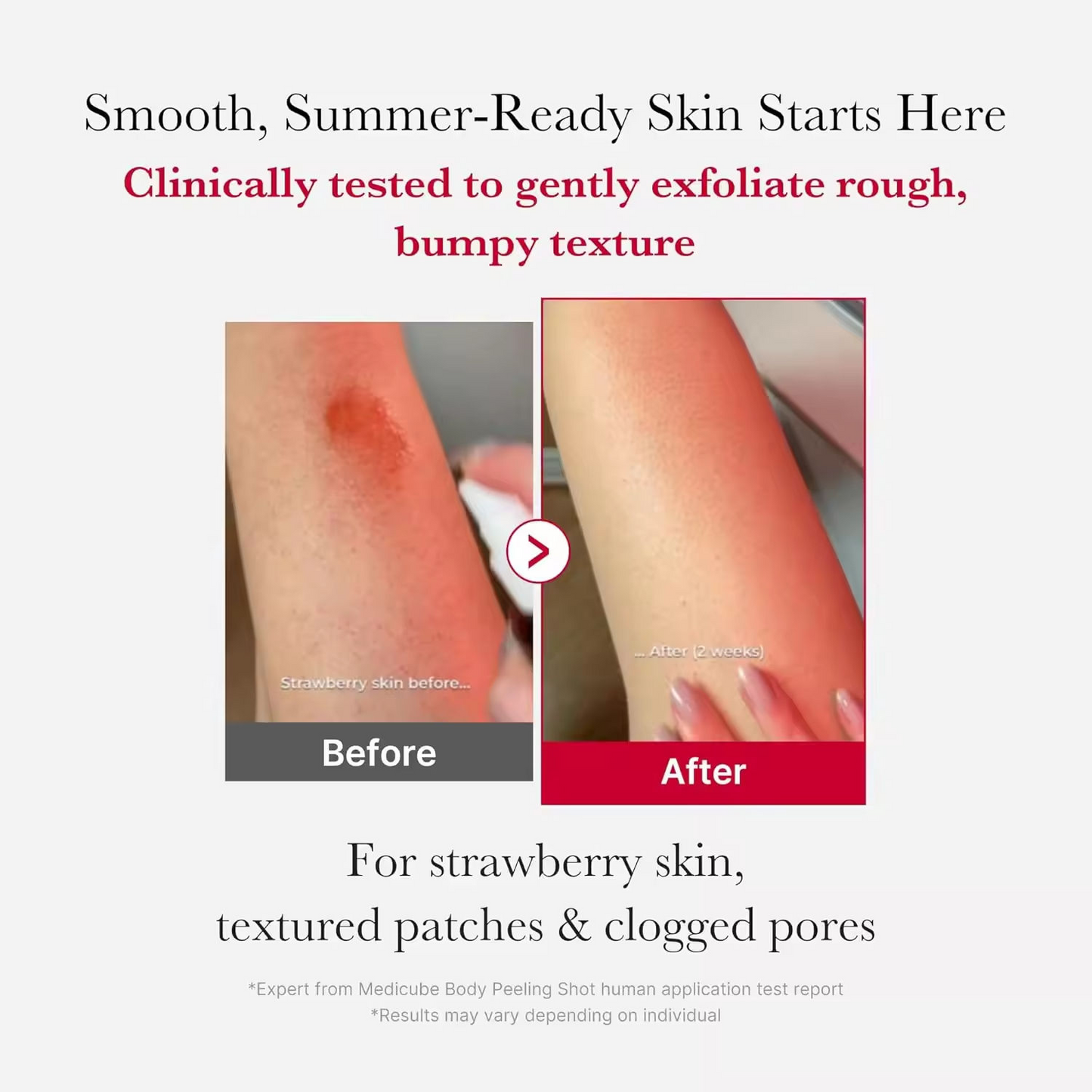 AHA + BHA Exfoliating Body Cleanser – Skin Smoothing & Refreshing Body Care